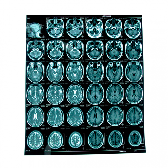 青いインクジェット医療X線フィルム 医療乾燥フィルムA4A3シートまたはロール 0