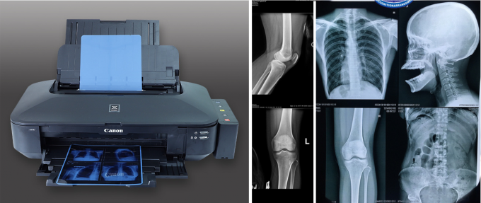 高鋭さと低霧のインクジェットプリンターのための青い医療X線フィルム 5