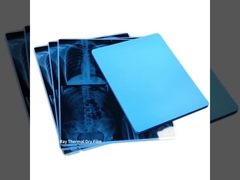 14*17は35x43cm富士のスクリーンの印刷のための医学の乾燥したフィルムのインクジェット透明物のフィルムをじりじり動かす